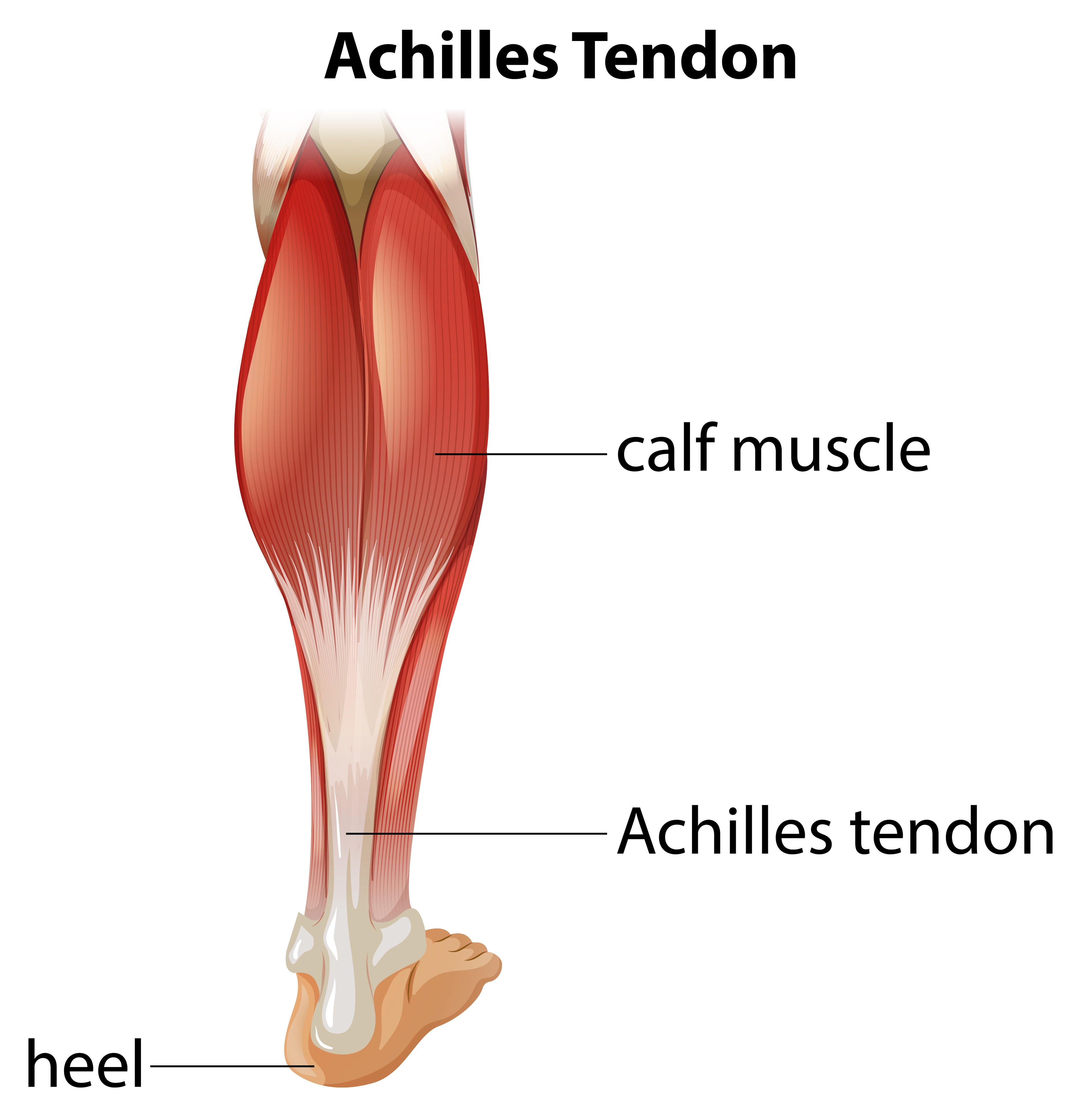 Midpoint & Insertional Achilles Tendonitis